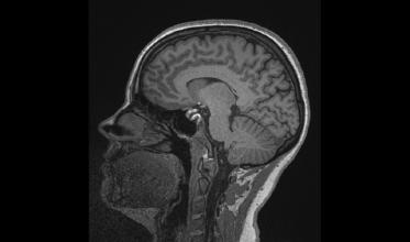 brain scan